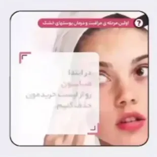 شیر پاکن لدورا