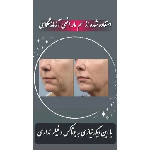 سرم پر کننده و سفت کننده صورت وایپر لدورا