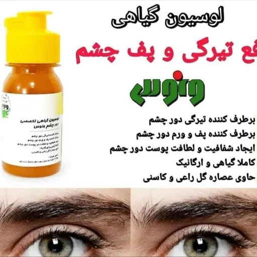 سرم رفع پف و تیرگی دورچشم ونوس