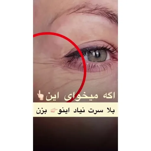 کرم سفت کننده دور چشم و لب وایپر