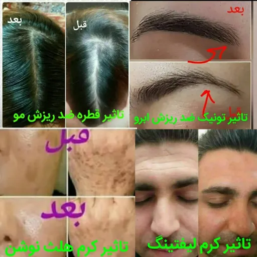 تونیک ابرو، ضد ریزش مو، لیفتینگ ماساژوردار، کرم هلث نوشن