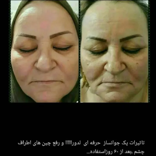 پک کامل ضد چین و چروک و جوانساز لدورا