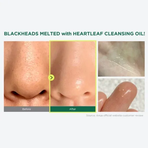 روغن پاک کننده و کنترل منافذ مدل Heartleaf آنوا